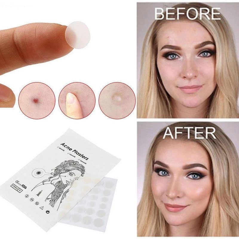 Acne Pimple Removal Patch
