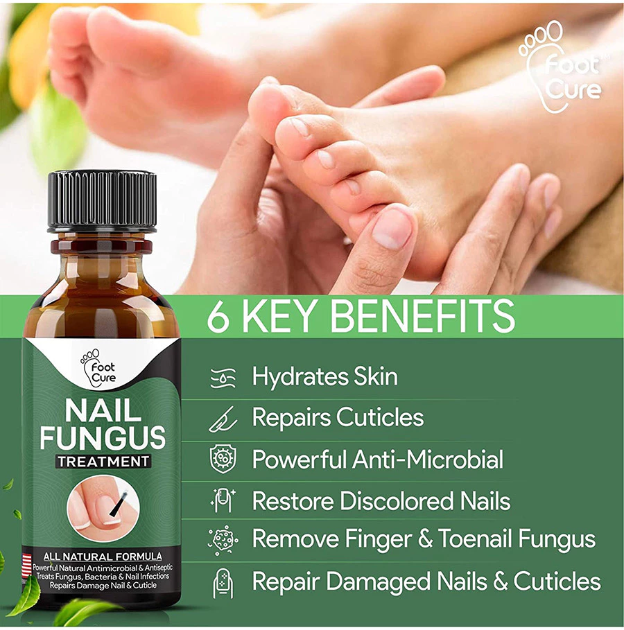 Nail Fungus Treatment